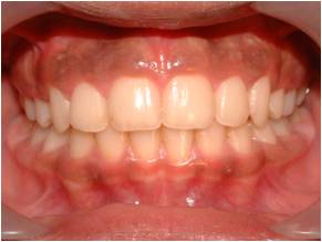 Orthodontics3_1
