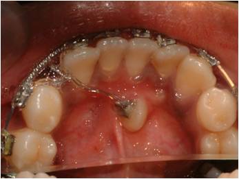 Orthodontics2_1