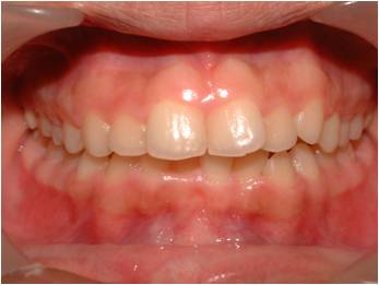 Orthodontics3_1
